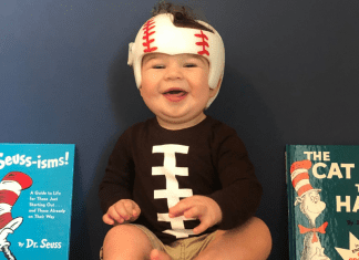 Jessica's son with a cranial helmet (Plagiocephaly and a Cranial Helmet: It's Not As Scary As It Looks Jessica Socarras Contributor Miami Mom Collective)