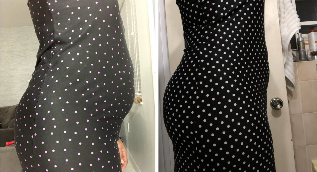 Before and after pictures of a woman in a polka dot dress (Group Fitness Training: 3 Things I Learned When I Joined Janeris Marte Contributor Miami Mom Collective)