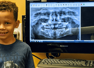 A pediatric dental patient pictured next to one of his x-rays