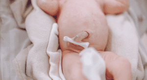 A newborn baby with a clamped umbilical cord
